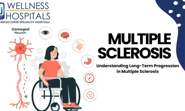 Care Of Patient With Multiple Sclerosis at Kayla Omay blog
