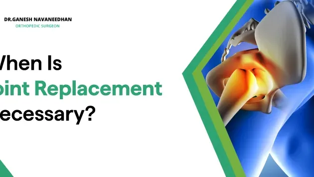Reasons why should you need to undergo joint replacement surgery